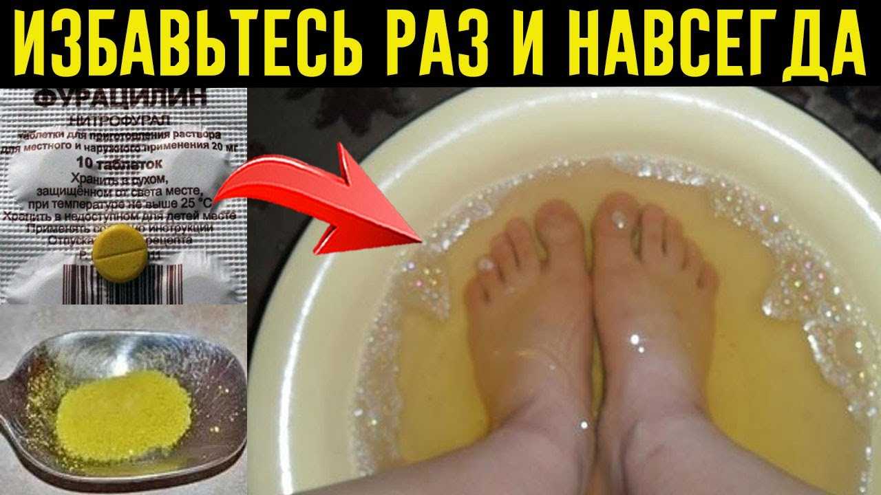 Почему возникает запах лука изо рта - причины и способы избавления