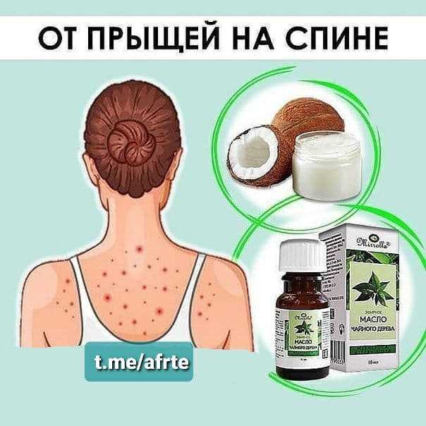 Как убрать прыщи на попе?