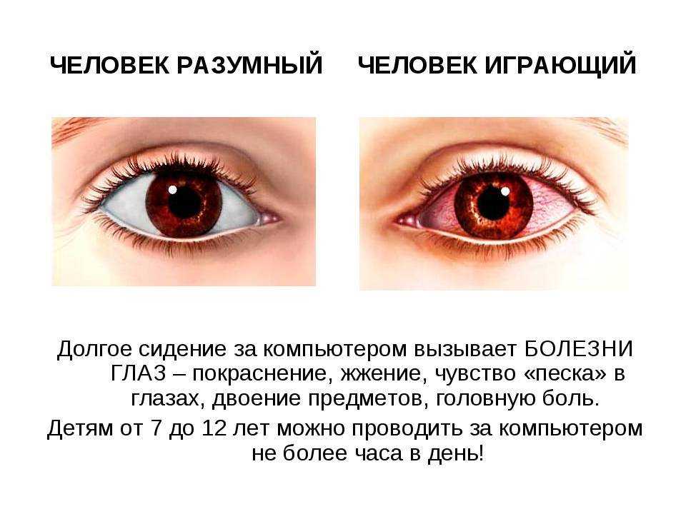 Почему человек опускает глаза при встрече. что вы должны знать