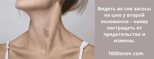 Как самому себе сделать засос на теле. будьте всегда в настроении