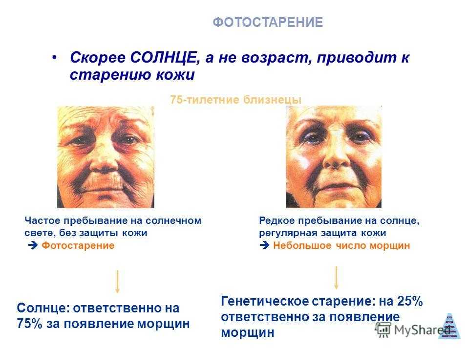 Кожа, повреждённая солнцем, вред загара