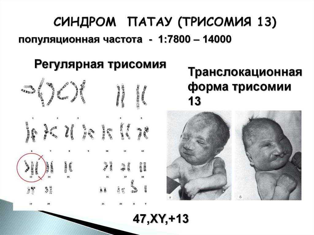 Солнечные дети - кто это такие? почему у здоровых родителей рождаются дети с синдромом дауна?
