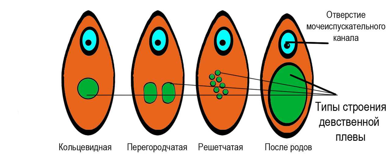 Муж упрекает, что я была не девственница - 3 совета психологов, консультации