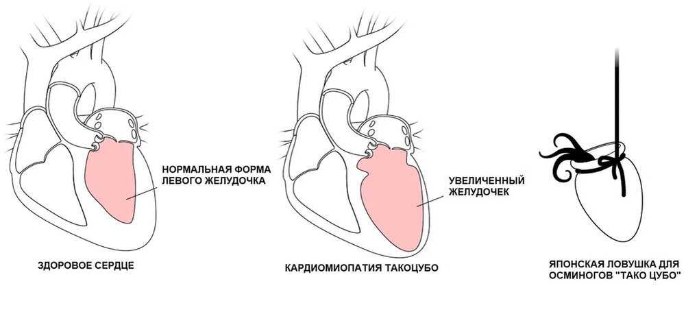 Любовь – это боль... так ли это? зависит ли это от того, как любить?..