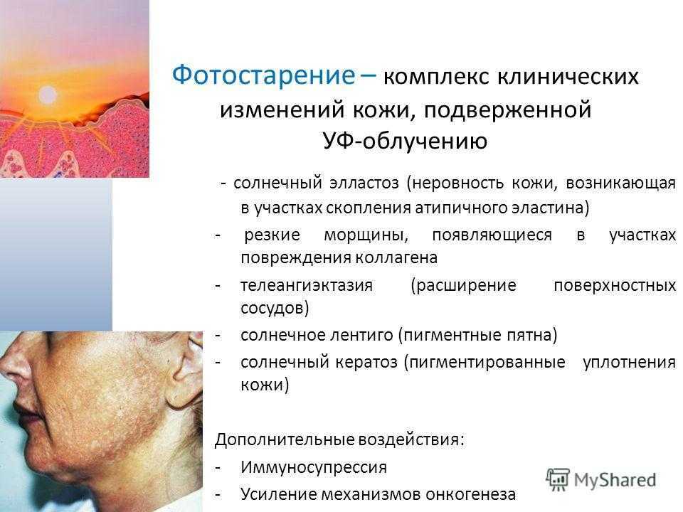 Как загореть красиво, безопасно и быстро, минуя стадию «обгоревший нос»: статья про солнцезащитные кремы и не только — статья на тчк